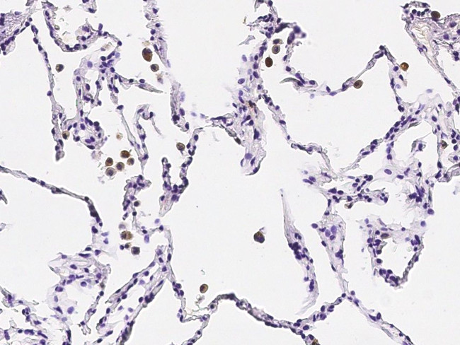 Tartrate Resistant Acid Phosphatase Antibody in Immunohistochemistry (Paraffin) (IHC (P))