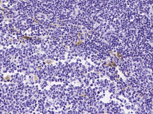 Tartrate Resistant Acid Phosphatase Antibody in Immunohistochemistry (Paraffin) (IHC (P))