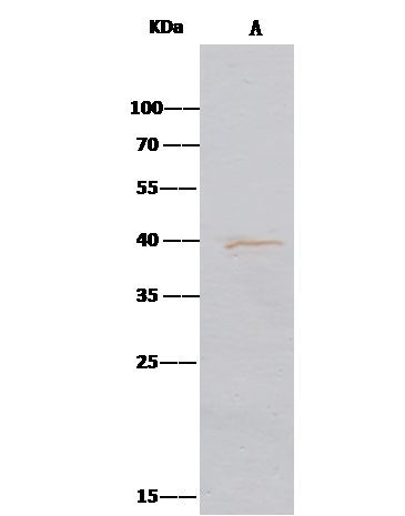 Aminoacylase Antibody in Immunoprecipitation (IP)