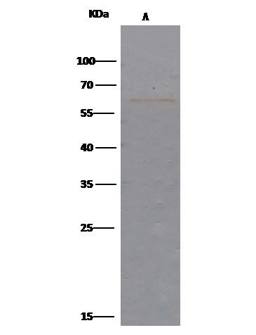 AKT1 Antibody in Immunoprecipitation (IP)