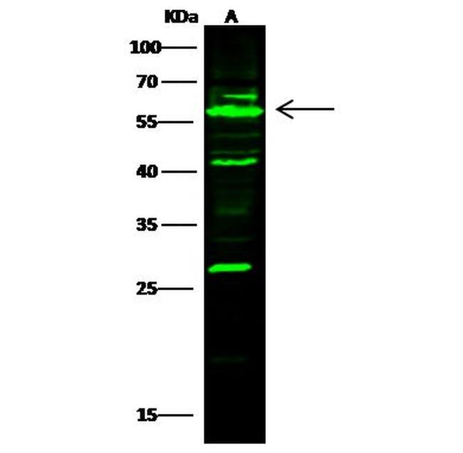 AKT1 Antibody in Western Blot (WB)