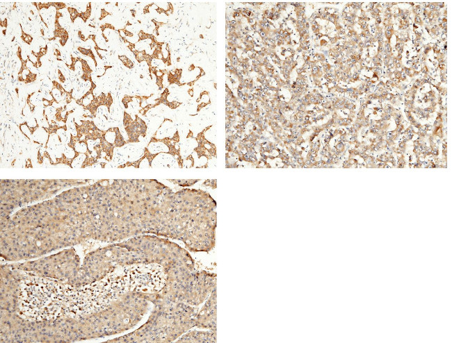 ALDH7A1 Antibody in Immunohistochemistry (Paraffin) (IHC (P))