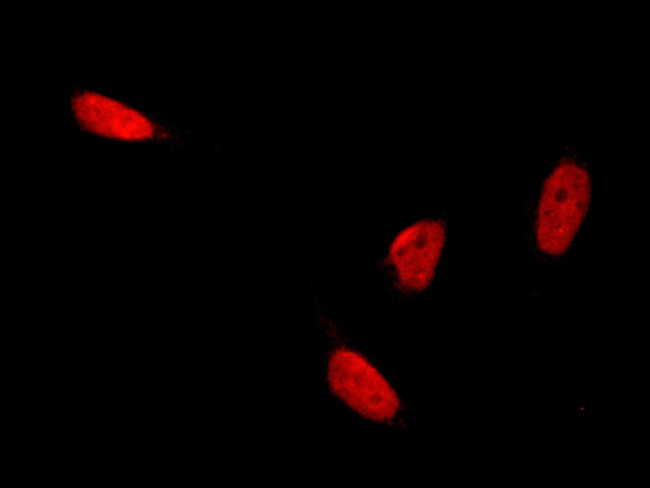 HP1 gamma Antibody in Immunocytochemistry (ICC/IF)