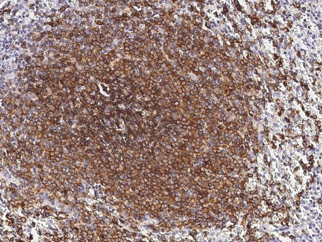 CD22 Antibody in Immunohistochemistry (Paraffin) (IHC (P))