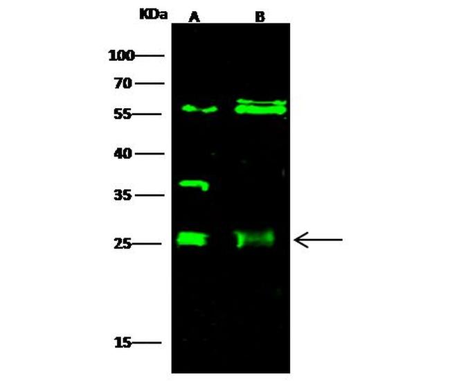 ETHE1 Antibody in Western Blot (WB)