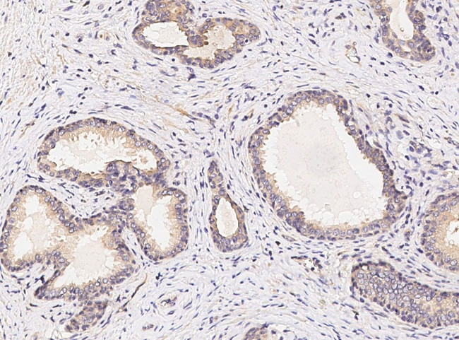 GABARAPL2 Antibody in Immunohistochemistry (Paraffin) (IHC (P))