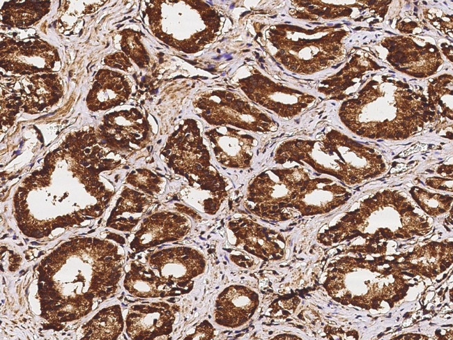 GALE Antibody in Immunohistochemistry (Paraffin) (IHC (P))