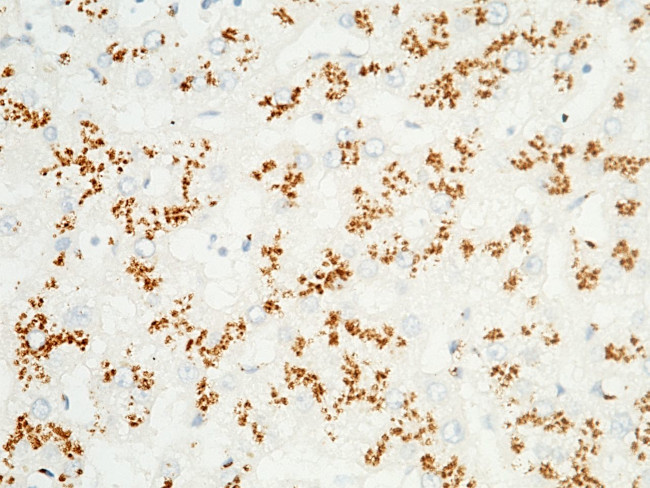 GOLPH2 Antibody in Immunohistochemistry (Paraffin) (IHC (P))