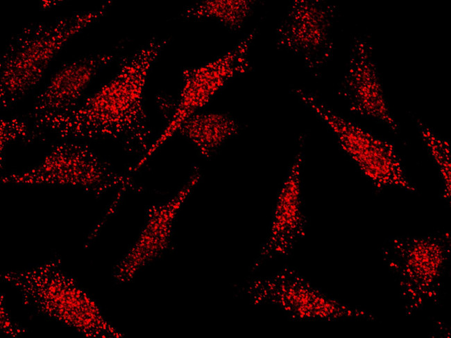 KLF5 Antibody in Immunocytochemistry (ICC/IF)