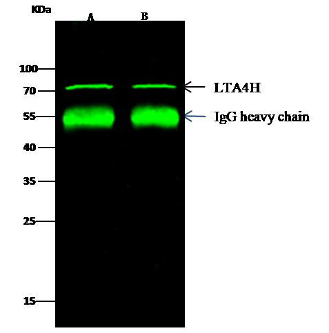 LTA4H Antibody in Immunoprecipitation (IP)