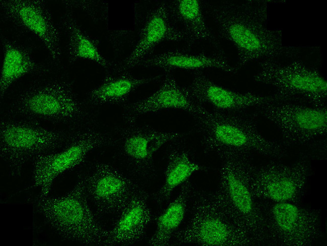 MAP2K4 Antibody in Immunocytochemistry (ICC/IF)