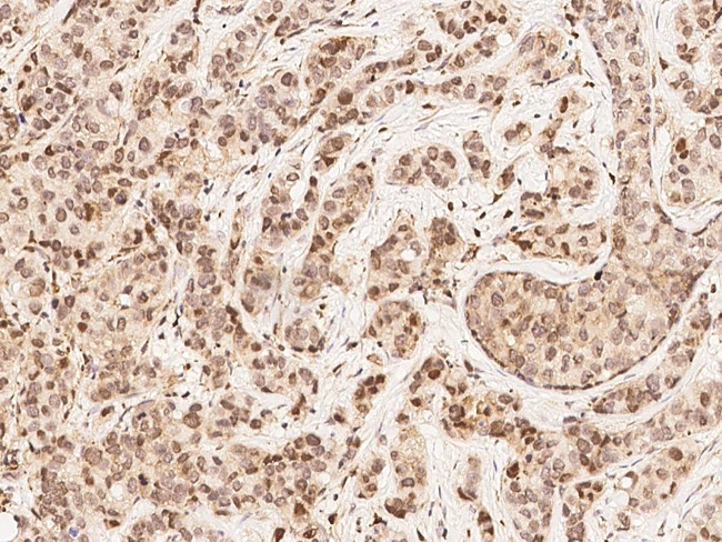 MAP2K4 Antibody in Immunohistochemistry (Paraffin) (IHC (P))