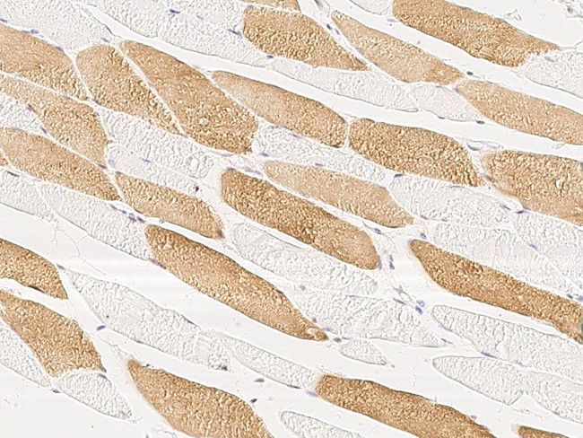 MAP2K4 Antibody in Immunohistochemistry (Paraffin) (IHC (P))