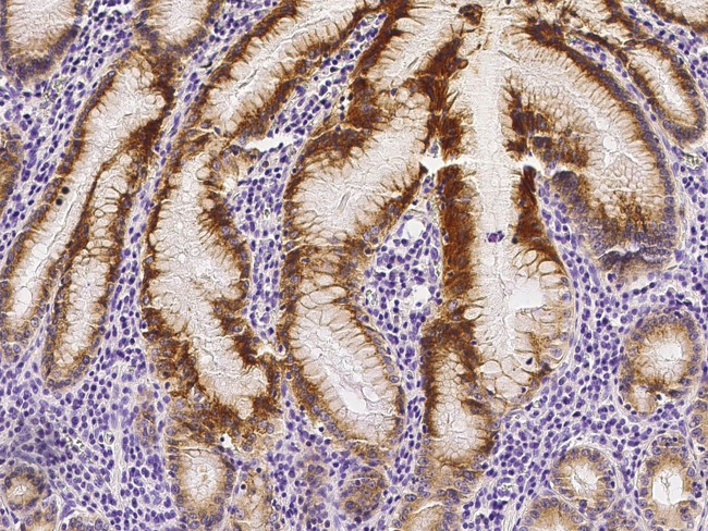 RON Antibody in Immunohistochemistry (Paraffin) (IHC (P))