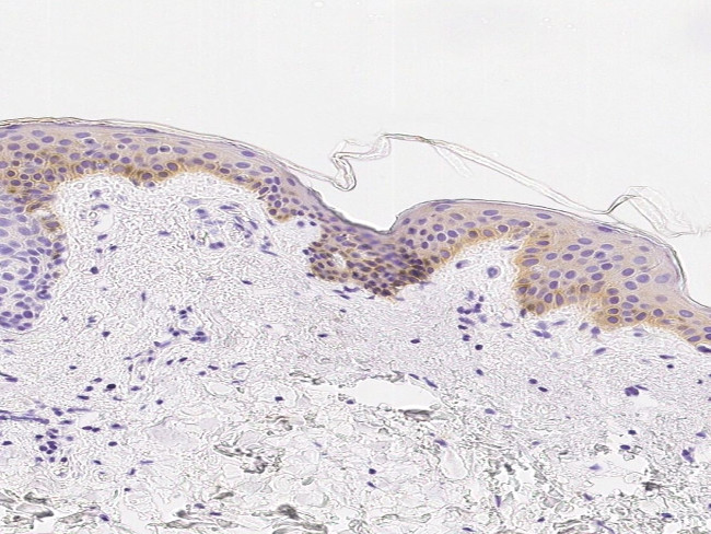 RON Antibody in Immunohistochemistry (Paraffin) (IHC (P))