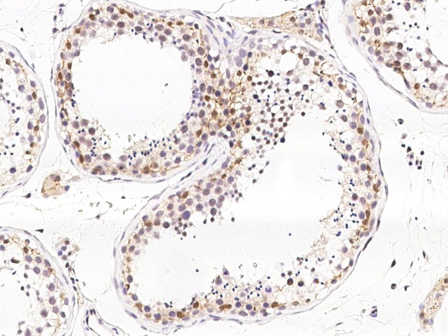 NR0B1 Antibody in Immunohistochemistry (Paraffin) (IHC (P))