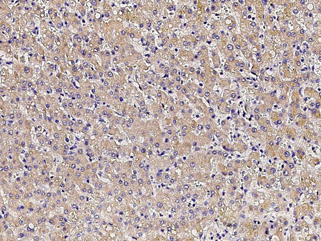 PCSK9 Antibody in Immunohistochemistry (Paraffin) (IHC (P))