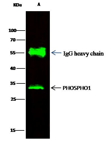 PHOSPHO1 Antibody in Immunoprecipitation (IP)