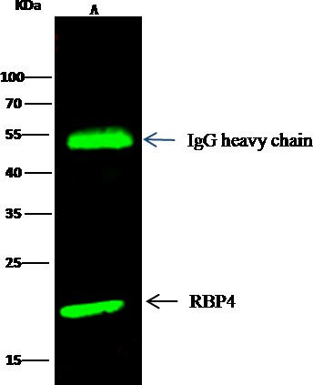 RBP4 Antibody in Immunoprecipitation (IP)