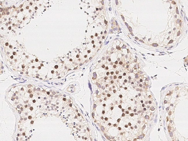 PRC1 Antibody in Immunohistochemistry (Paraffin) (IHC (P))