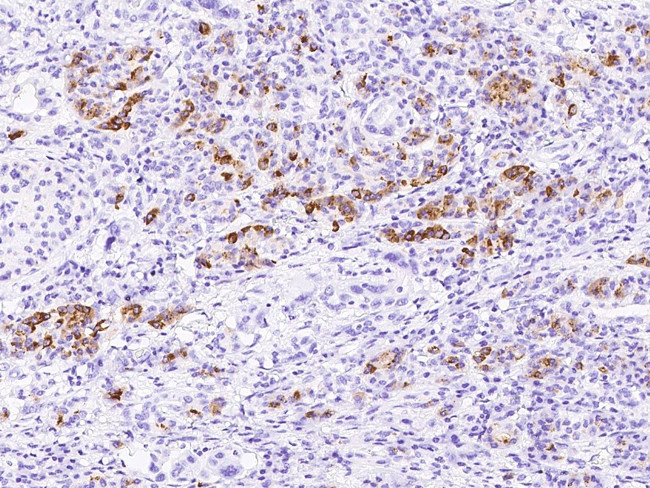 REG3A Antibody in Immunohistochemistry (Paraffin) (IHC (P))