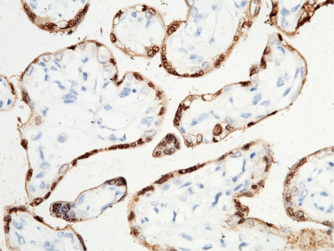 S100P Antibody in Immunohistochemistry (Paraffin) (IHC (P))