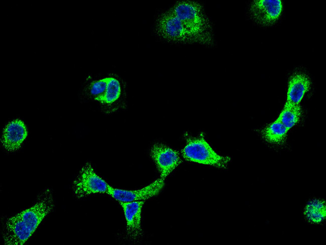 SEMA6A Antibody in Immunocytochemistry (ICC/IF)