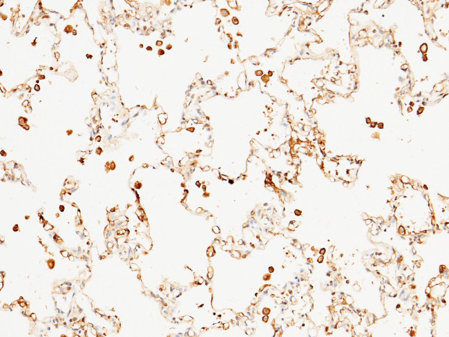 C1 inhibitor Antibody in Immunohistochemistry (Paraffin) (IHC (P))