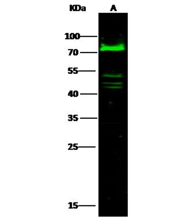 C1 inhibitor Antibody in Western Blot (WB)