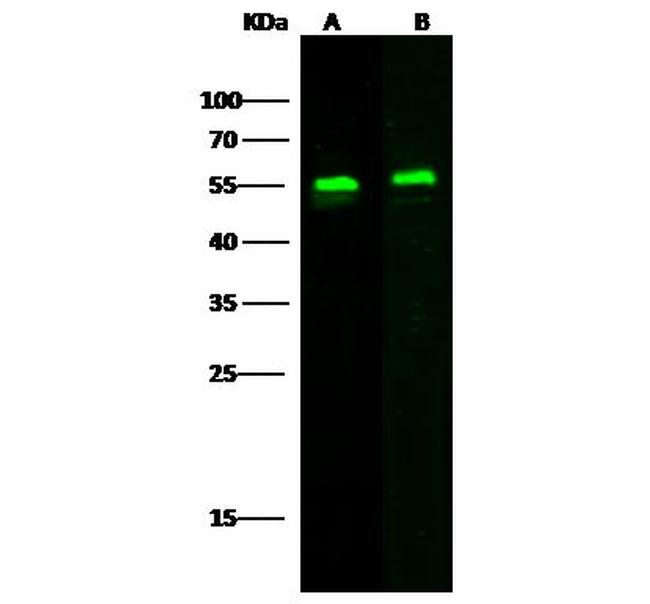 ST6GAL1 Antibody in Western Blot (WB)