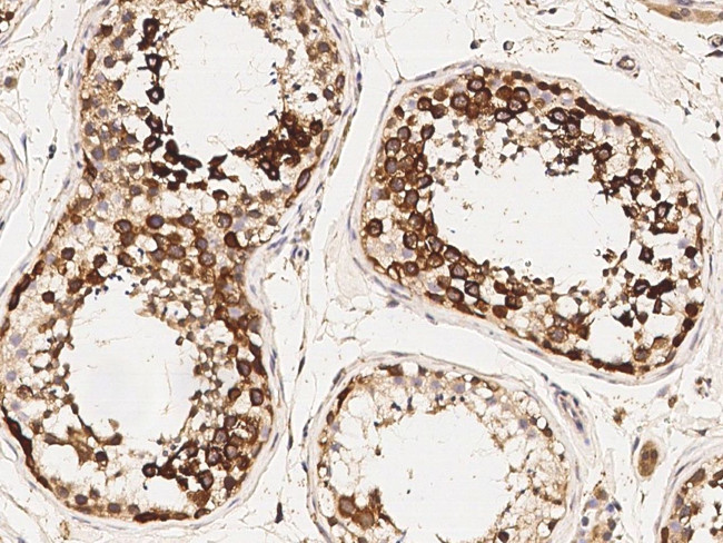 TACC3 Antibody in Immunohistochemistry (Paraffin) (IHC (P))