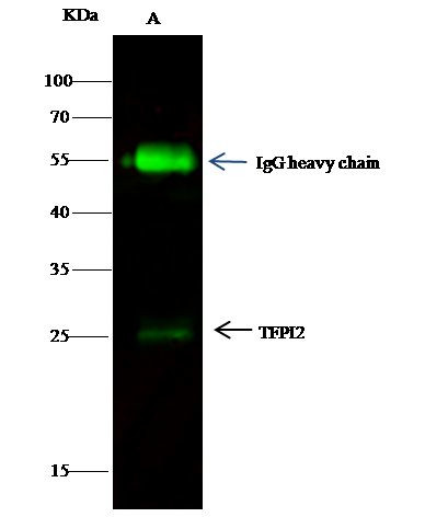 TFPI2 Antibody in Immunoprecipitation (IP)