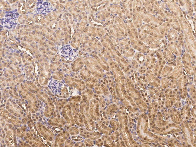 TRAF4 Antibody in Immunohistochemistry (Paraffin) (IHC (P))