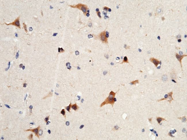 VWC2 Antibody in Immunohistochemistry (Paraffin) (IHC (P))