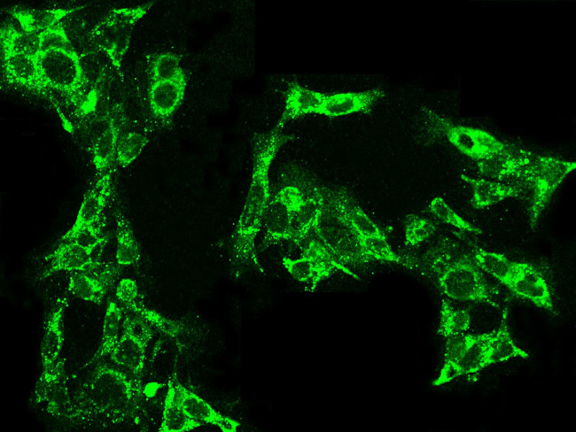 VWF Antibody in Immunocytochemistry (ICC/IF)