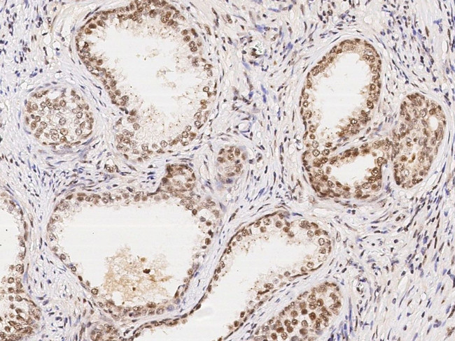 WDR77 Antibody in Immunohistochemistry (Paraffin) (IHC (P))