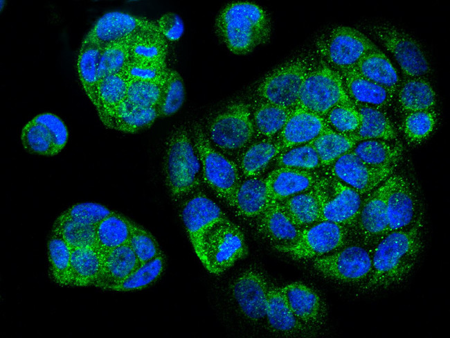 Cytochrome C Antibody in Immunocytochemistry (ICC/IF)