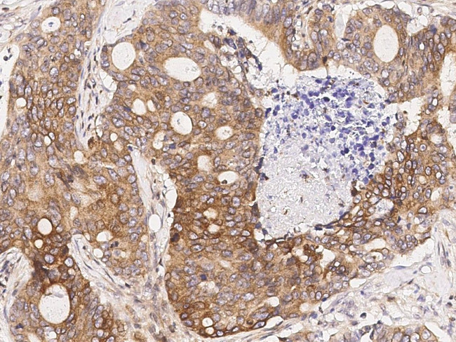 GDF5 Antibody in Immunohistochemistry (Paraffin) (IHC (P))