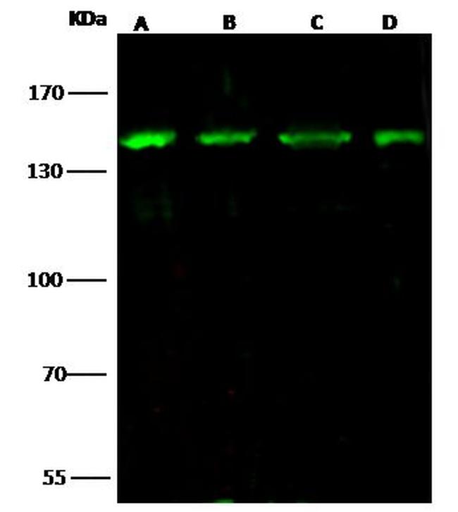 HDAC4 Antibody in Western Blot (WB)