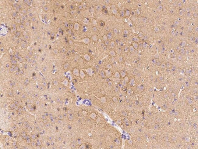 LRRTM2 Antibody in Immunohistochemistry (Paraffin) (IHC (P))