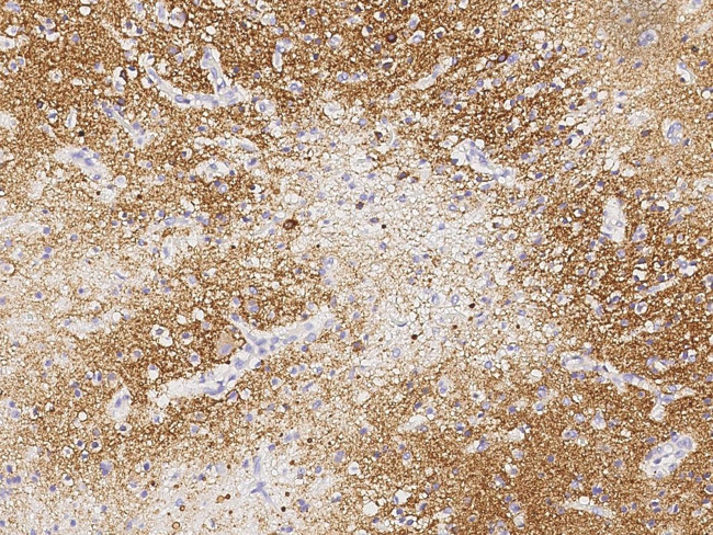 LRRTM2 Antibody in Immunohistochemistry (Paraffin) (IHC (P))