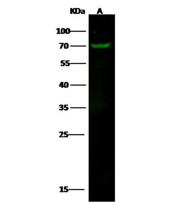 NUMB Antibody in Western Blot (WB)