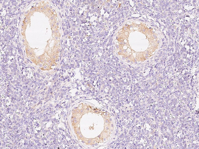 PIK3R2 Antibody in Immunohistochemistry (Paraffin) (IHC (P))