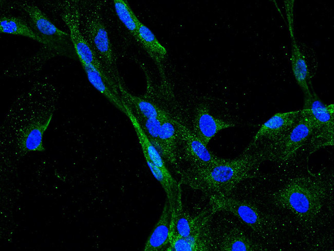 GRID2 Antibody in Immunocytochemistry (ICC/IF)