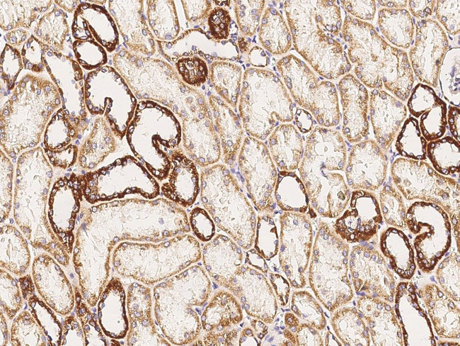 GRID2 Antibody in Immunohistochemistry (Paraffin) (IHC (P))