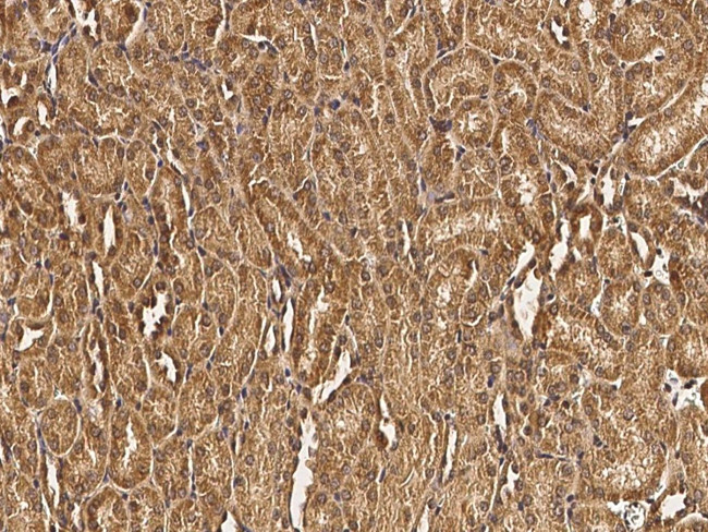 GRID2 Antibody in Immunohistochemistry (Paraffin) (IHC (P))