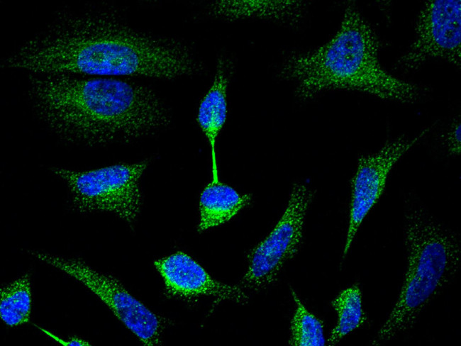 LDHA Antibody in Immunocytochemistry (ICC/IF)