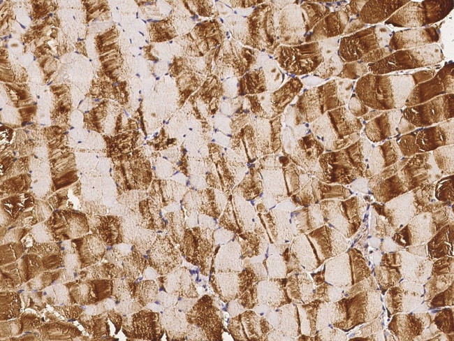 LDHA Antibody in Immunohistochemistry (Paraffin) (IHC (P))