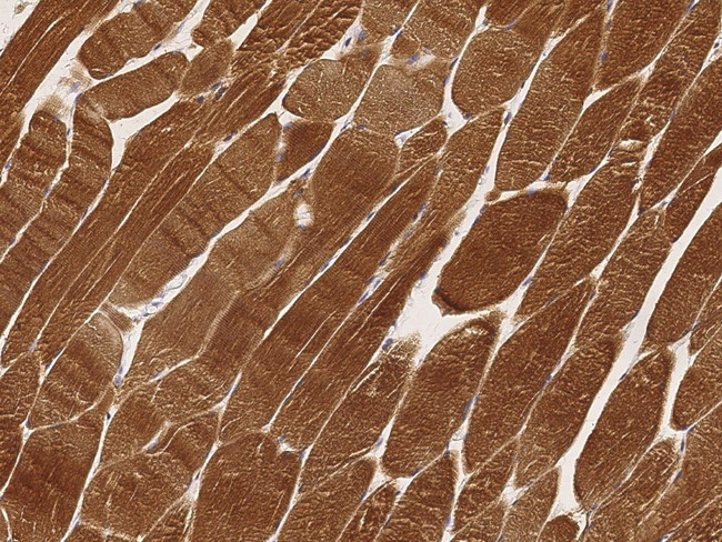 LDHA Antibody in Immunohistochemistry (Paraffin) (IHC (P))