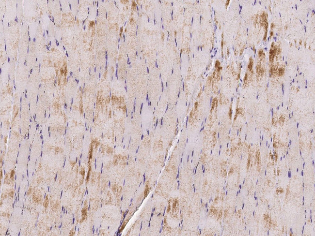 LDHA Antibody in Immunohistochemistry (Paraffin) (IHC (P))